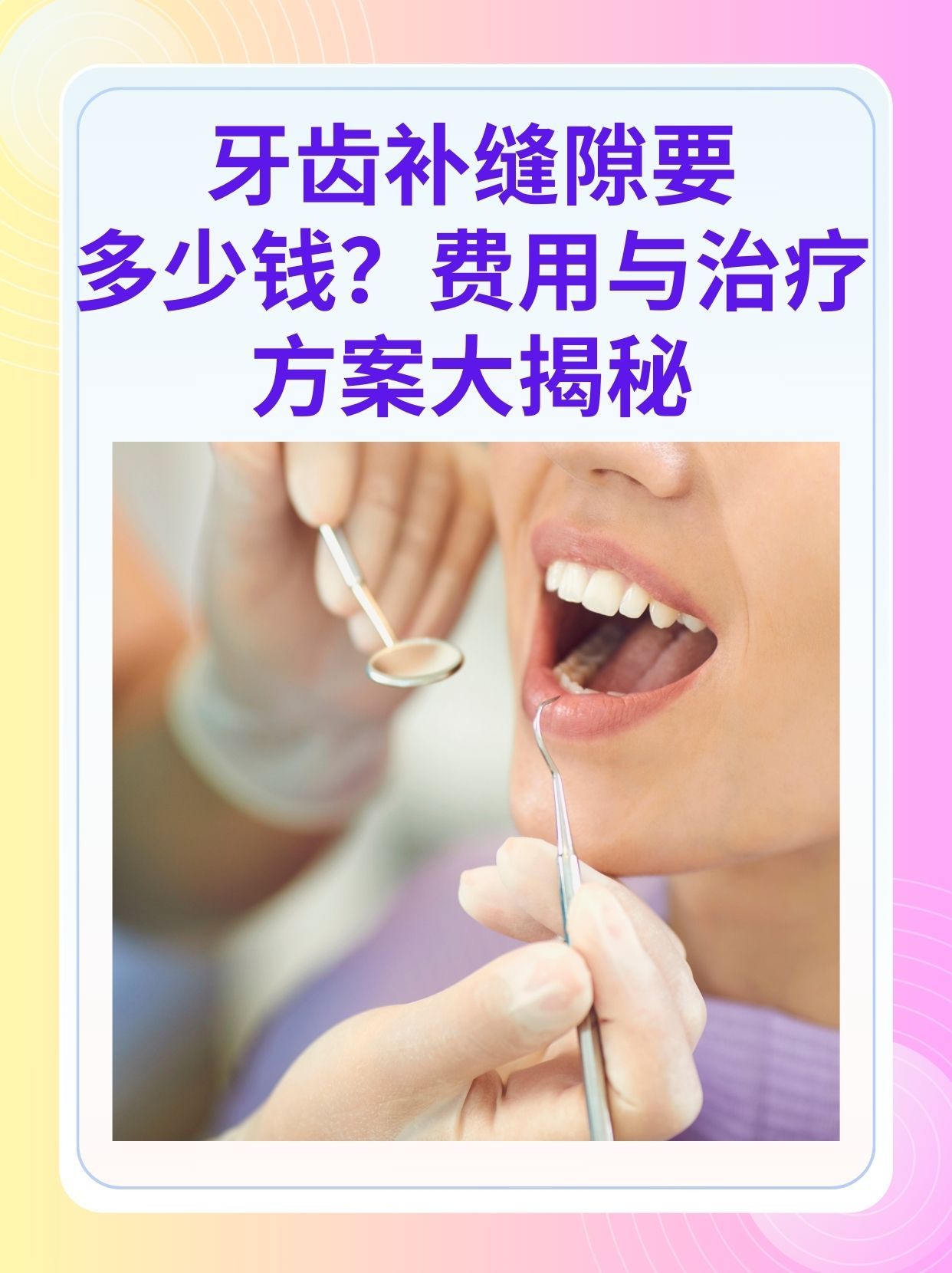 淮北补牙医保可以报销吗(补牙医保可以报销吗 哪些可以报销呢)